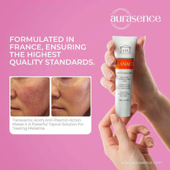 Tranacix Cream 30g in UAE – Treating Melasma – Aurasence