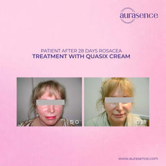 QUASIX Anti Redness Cream | Anti-Redness & Moisturizer for Dry & mixed | Soothes Irritation & Hydrates | Quassia Amara extract – 30ml