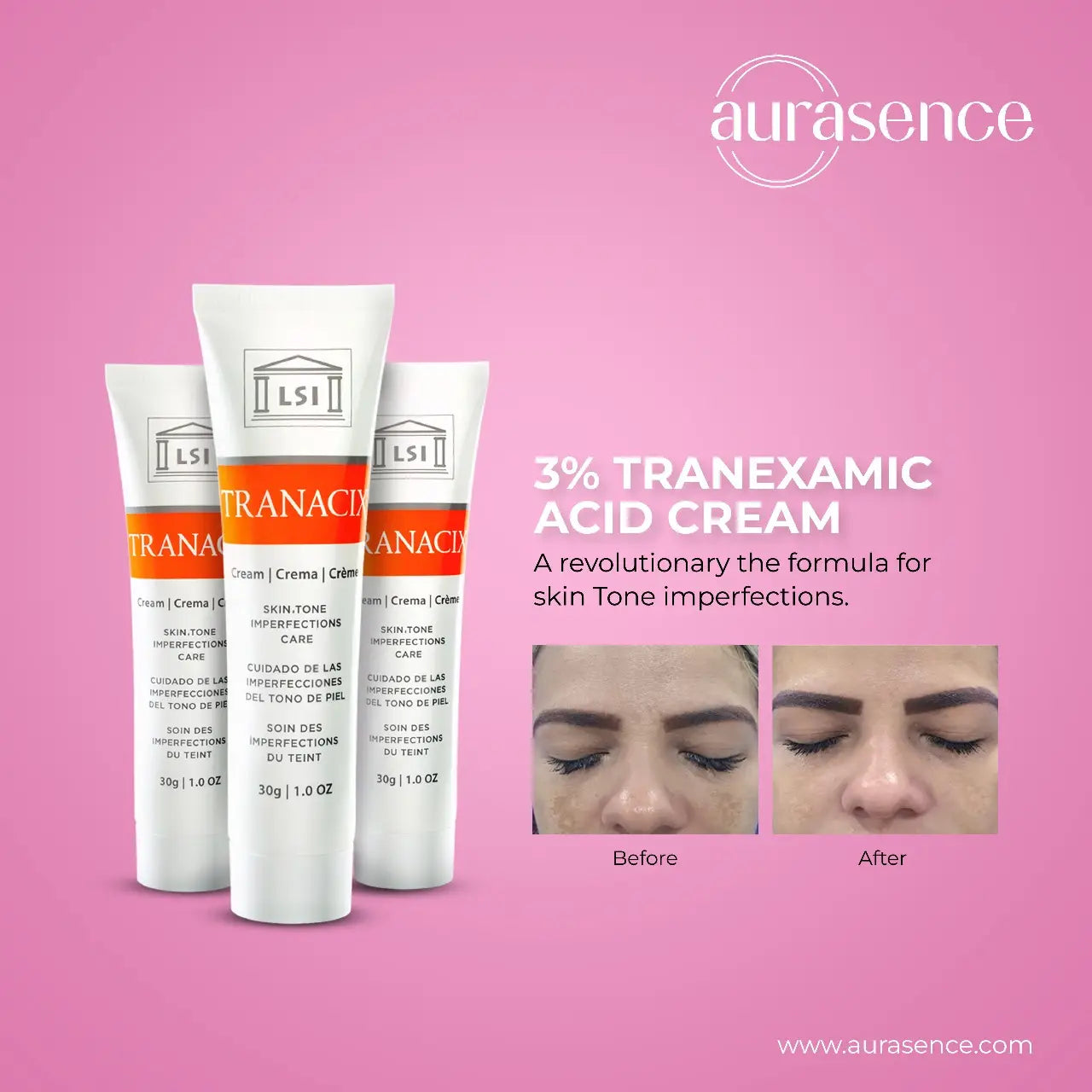 Tranacix Cream 30g in UAE –3% Tranacix Acid Cream – Aurasence