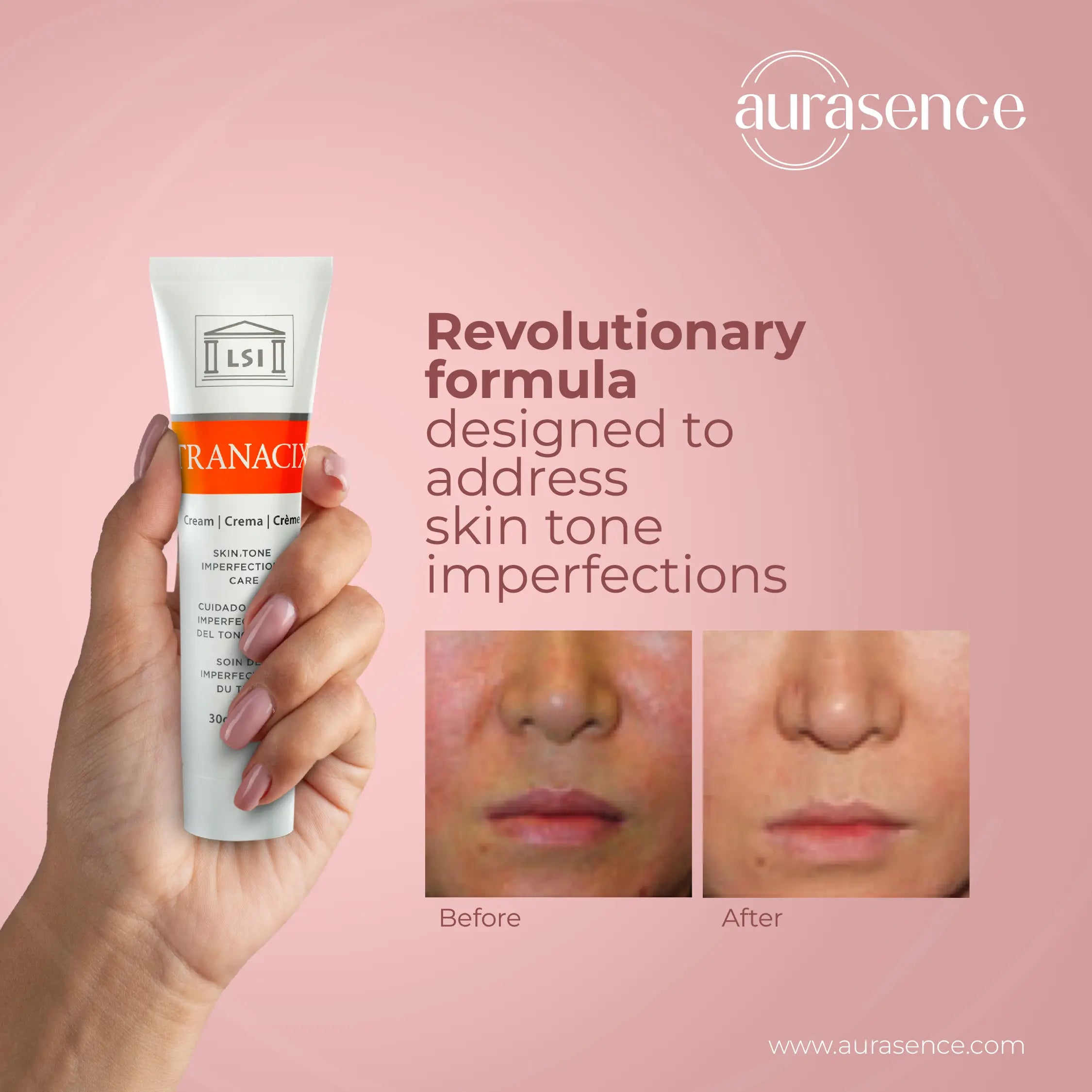 Tranacix Cream 30g in UAE – Revolutionary Formula – Aurasence