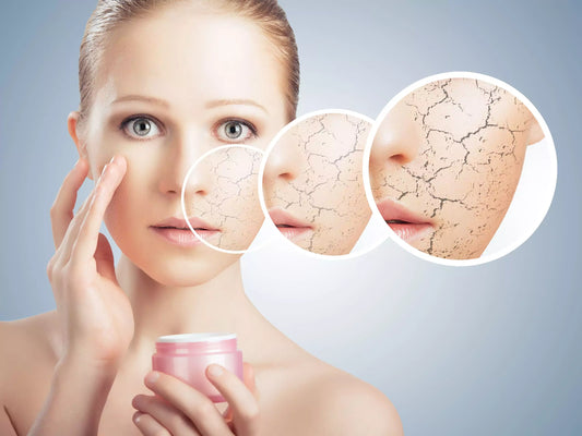 Uphold Hydration: Top Moisturizers for Dry Skin in UAE