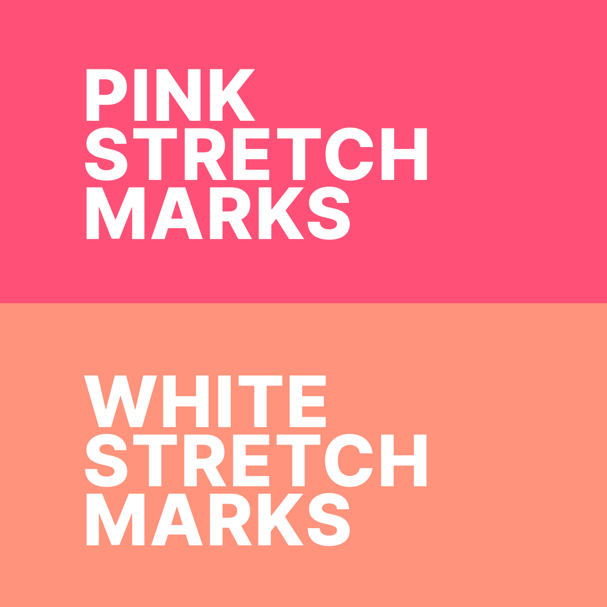 STRIANIX-P Pink Stretch Marks Removal Cream 50g