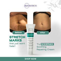 SODERMIX Soothing Stretch Marks Repairing Cream | steroid-free solution for hypertrophic and keloid scars- 30ml