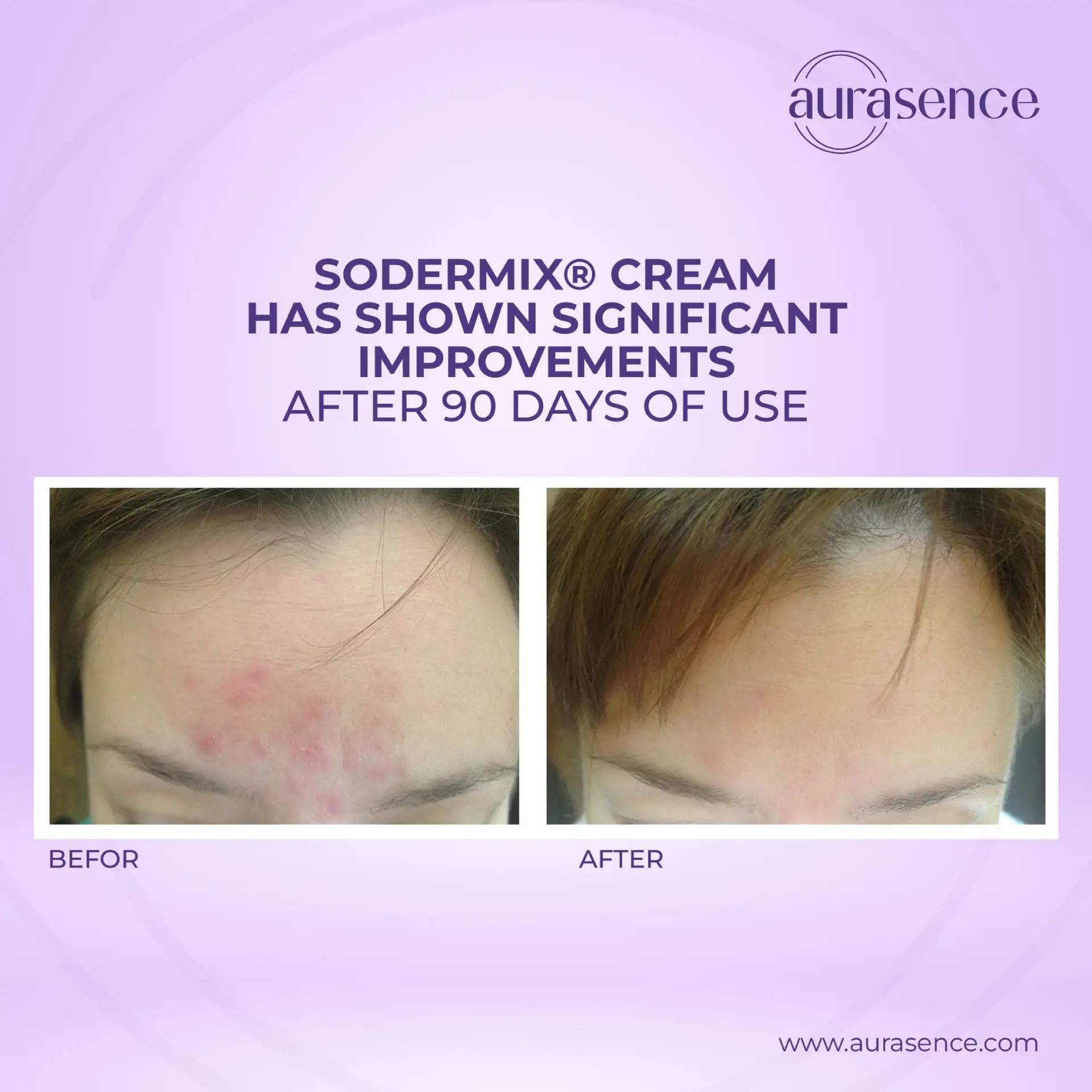 SODERMIX Cream – 30ml